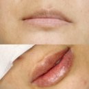 시흥 반영구 장현동 입술문신 유리뷰티샵 솔직후기