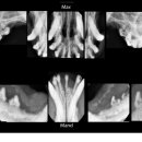 말티스토리 이미지
