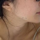 비아트의원 이미지