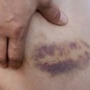 R1 운동과학센터 이미지