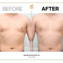 탱글성형외과의원 이미지