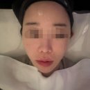 바이미인 | 역삼피부관리 케어바이미 1:1 맞춤 여배우케어 후기