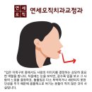 (주)다해특장 | 휘경동교정치과 돌출입인데 발치 없이 교정하고 싶어요(feat.가능합니다만:-)