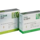 조인트