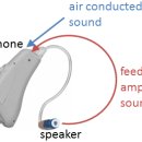 진해독일보청기 이미지