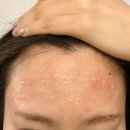 테시토의원 | [ 합정, 홍대, 마포 ]내돈내산 테시토 의원 후기 콜라겐 부스터