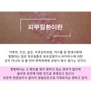 방패한의원 네이버블로그