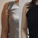 성신여대 지방흡입 추천 당일부터 3주차까지 전후비교 솔직후기