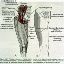 Scoliosis and Pelvic Tortion Type 요추신경 폐색 이미지