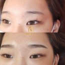임뷰티 이미지