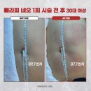 주식회사 메디앤피스 | 바디관리실이 성장하는 과정에서 빼라피 네오가 어떻게 핵심 장비로 자리 잡는가