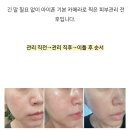 41190-01-07-177 | 부천 피부관리 리프팅 후기