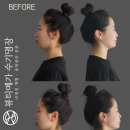 뷰티테라피 | 부산체형관리 뷰티예가 수기명장에서 뷰티재활테라피 후기