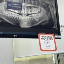 서울턱사랑니치과 이미지