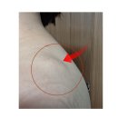 감암로 | 김포 우리병원 지방종 제거 수술 비용과 후기 총정리