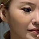 프리웨이스토어 | 팔자주름없애기 효과 제대로 본 아우라오라 리프팅 관리 후기