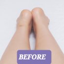 카이로체형관리 | 공덕역 체형교정 마포체형교정 웰카이로모션에서 체형교정과 얼굴관리까지 받은 솔직 후기