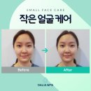약손스킨케어 이미지