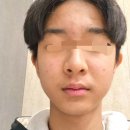 인천광역시 부평구 부개1동 대상포진 전문병원 추천 | 무료접종 | 예방접종