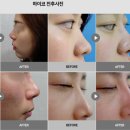 미네트워크 이미지