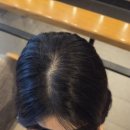 디에이시스템 | 대구 두피문신 디에이스칼프 대만족!! 내돈내산 가르마커버 후기