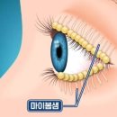 핫플짐 이미지