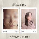 상보빌딩 | 경북 피부관리 구미 브니엘뷰티 색소 침착 해결 후기