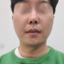구로/신림 피부 미백관리 잡티제거 미작뷰티구로점 솔직후기