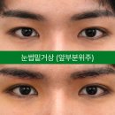 아이케이성형외과의원 네이버블로그