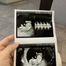 문산부인과 이미지