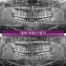 박경수치과의원 네이버블로그