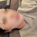 아이케이의원 신부관리 쿨페이즈 리프팅 후기