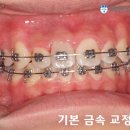 더바른 치과기공소 이미지