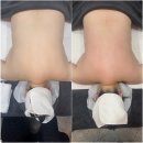 인천 웨딩케어, 부평 테라노바로 부평 바디슬리밍 등관리받은 찐 후기! [포티산 스킨멀티플렉스]