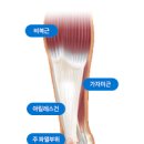 발바닥 발뒤꿈치 통증 원인과 증상 족저근막염 치료방법 및 추천 깔창 이미지