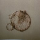 내 손안의 하모니카 : 중급 | 시험관3차/자연주기 7일배양(느린배아) 중급 눈사람배아 동결이식 후기/nk20/이식후증상