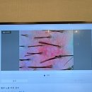 퇴계원15리(강남1차) | [남양주 두피관리] 민감성 두피로 퇴계원 숲칼프에서 두피·탈모 관리 받은 후기 !