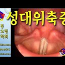 성대위축증 치료 방법 - 비과학적 양의학 198 - 사암침, 사암침법, 정통사암침 이미지