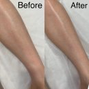 비니드니 | 대구 수성구 왁싱 비니드왁싱 다리 하프왁싱 받고 온 후기