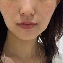 올림픽 LDM