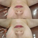새아뷰티 | 김해신부관리 내외동 새아뷰티피부관리 방문 후기