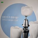 보석플란트치과의원 이미지