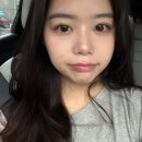 [손톱흉터치료] 천안두정역 새살침 흉터치료 5회차 후기