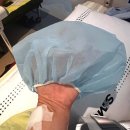 삼성정형외과의원 | 무지외반증 수술, 마취 순간부터 퇴원까지 (삼성서울병원 정형외과 후기)