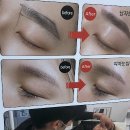 썬헤어라인 이미지