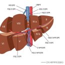 간암의 현대의학적 표준 치료 과정 이미지