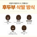 이혜영피부과의원 | 모발이식 병원 선정후기(모모성형외과)