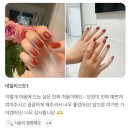 엔케어센터 | [리얼 리뷰💬] 대구 문제성 발톱 손톱 - 대구 엔케어센터