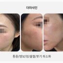 압구정튠의원 이미지