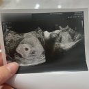 4주~10주] 제스의 임신 기록 / 초록 뱀띠 찰떡이 타임라인 / 구미 케이맘택시 / 임신 초기 증상, 감정🤰🏻👼🏻